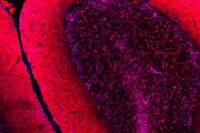 Cerebellum granule cells courtesy of colby samstag and mayumi yagi